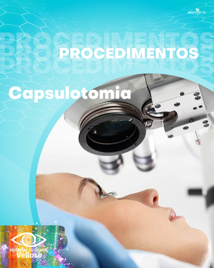 Procedimentos - Capsulotomia