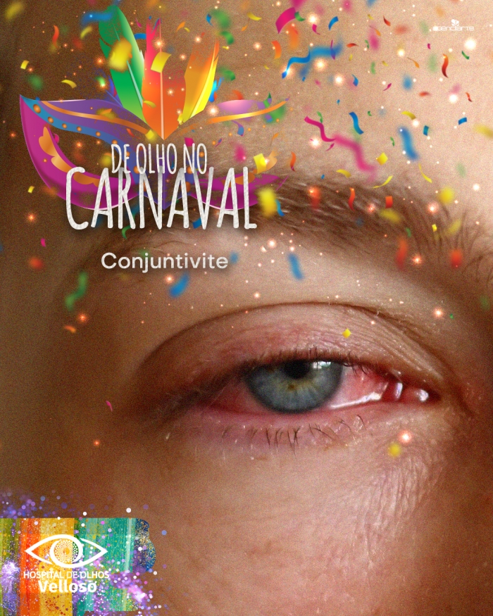 De olho no carnaval - Conjuntivite