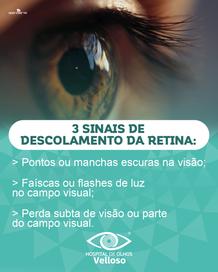 3 sinais de descolamento da retina