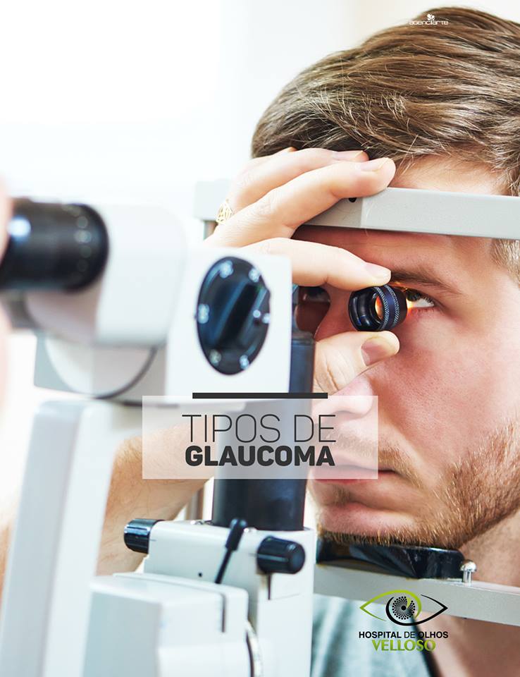 Tipos de glaucoma